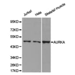 Anti-AURKA Antibody from Bioworld Technology (BS6903) - Antibodies.com