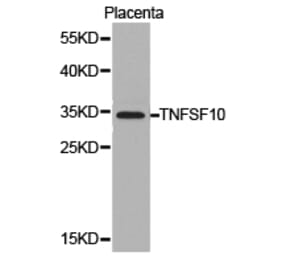 Anti-TRAIL/ TNFSF10 Antibody from Bioworld Technology (BS6907) - Antibodies.com