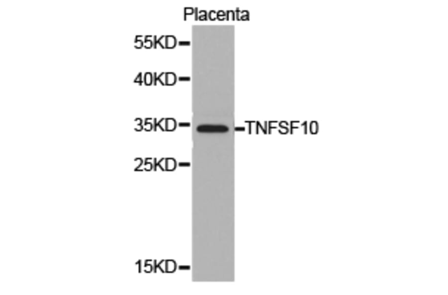Anti-TRAIL/ TNFSF10 Antibody from Bioworld Technology (BS6907) - Antibodies.com