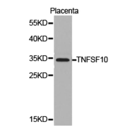 Anti-TRAIL/ TNFSF10 Antibody from Bioworld Technology (BS6907) - Antibodies.com