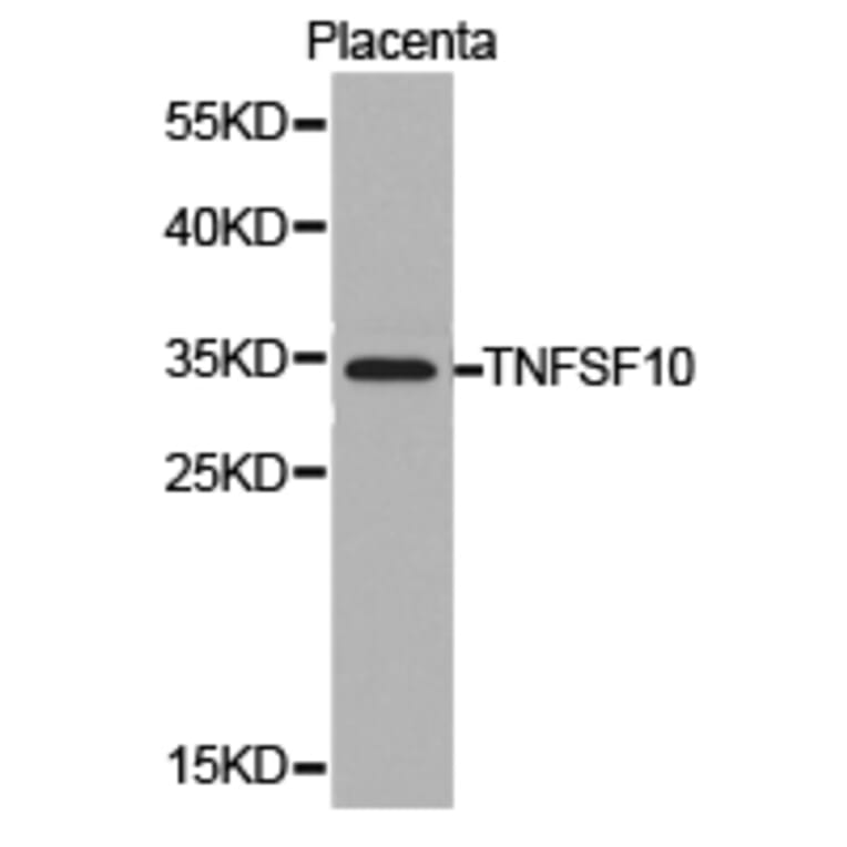 Anti-TRAIL/ TNFSF10 Antibody from Bioworld Technology (BS6907) - Antibodies.com