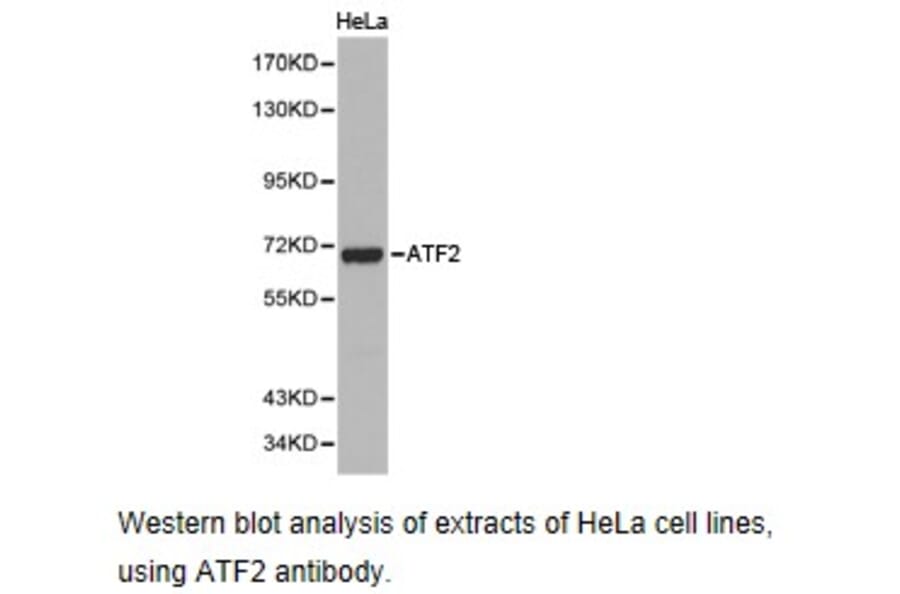 Anti-ATF2 Antibody from Bioworld Technology (BS6911) - Antibodies.com