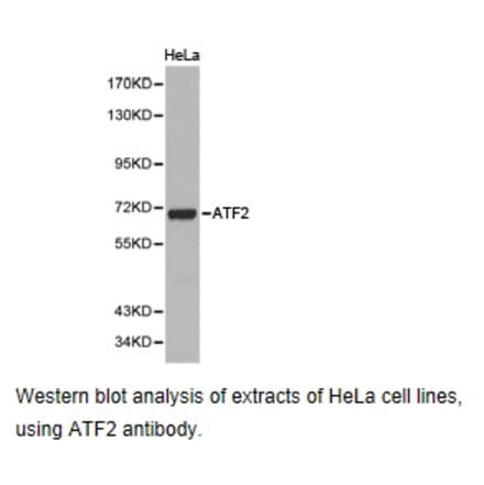 Anti-ATF2 Antibody from Bioworld Technology (BS6911) - Antibodies.com
