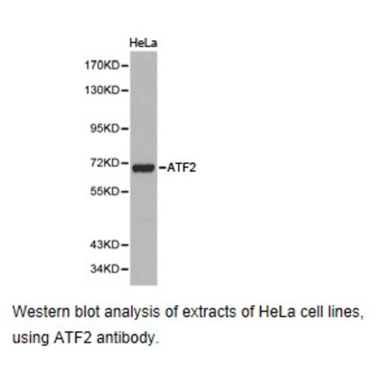 Anti-ATF2 Antibody from Bioworld Technology (BS6911) - Antibodies.com
