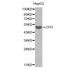 Anti-CFH Antibody from Bioworld Technology (BS6915) - Antibodies.com