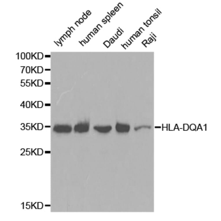 Anti-HLA-DQA1 Antibody from Bioworld Technology (BS6917) - Antibodies.com