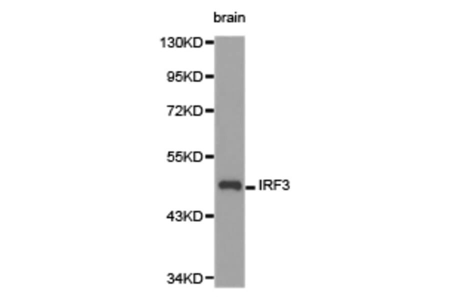 Anti-IRF3 Antibody from Bioworld Technology (BS6921) - Antibodies.com