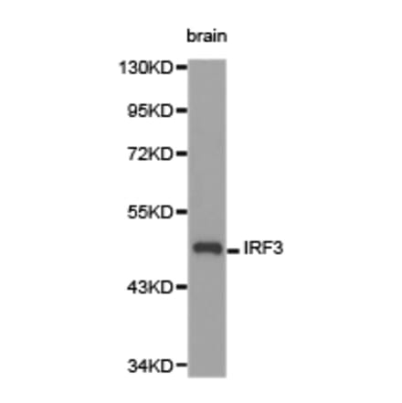 Anti-IRF3 Antibody from Bioworld Technology (BS6921) - Antibodies.com