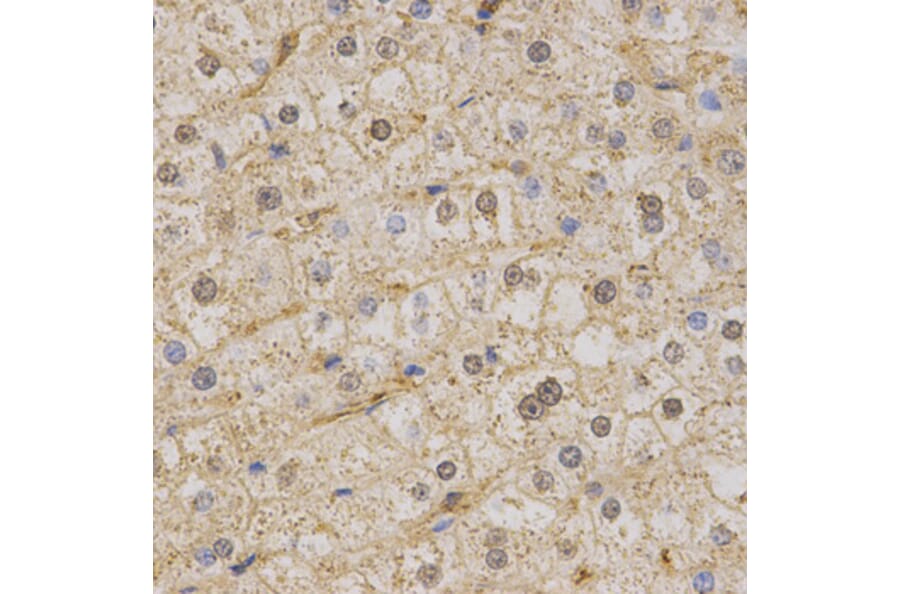 Anti-Kv7.1 Antibody from Bioworld Technology (BS6923) - Antibodies.com