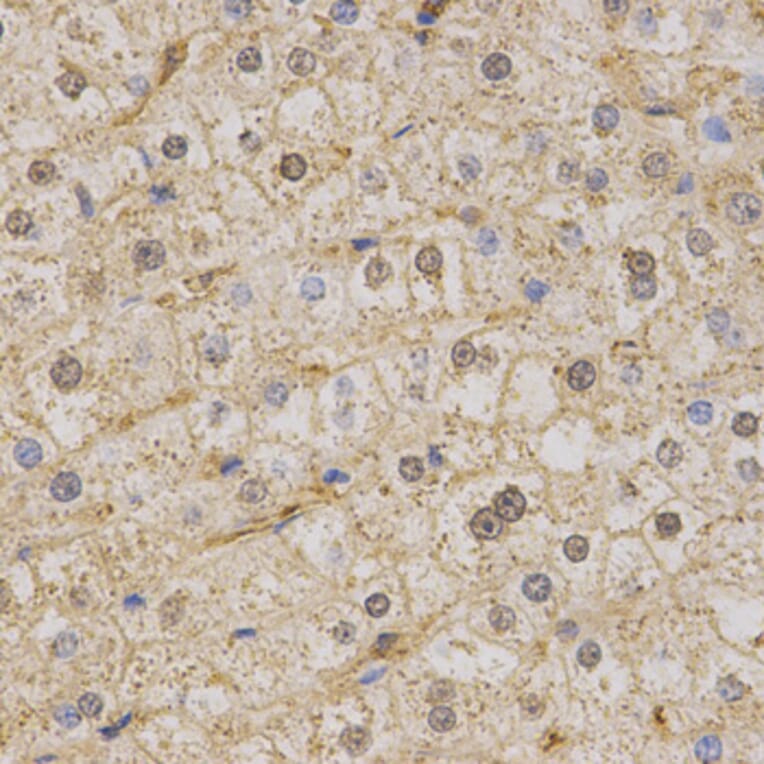 Anti-Kv7.1 Antibody from Bioworld Technology (BS6923) - Antibodies.com