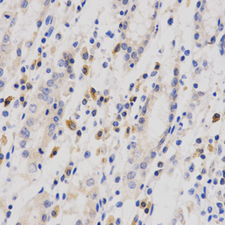 Anti-Op18 Antibody from Bioworld Technology (BS6924) - Antibodies.com