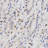 Anti-Op18 Antibody from Bioworld Technology (BS6924) - Antibodies.com