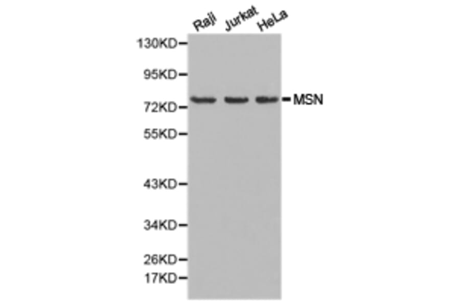 Anti-Moesin / MSN Antibody from Bioworld Technology (BS6925) - Antibodies.com