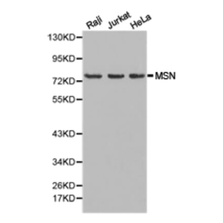 Anti-Moesin / MSN Antibody from Bioworld Technology (BS6925) - Antibodies.com