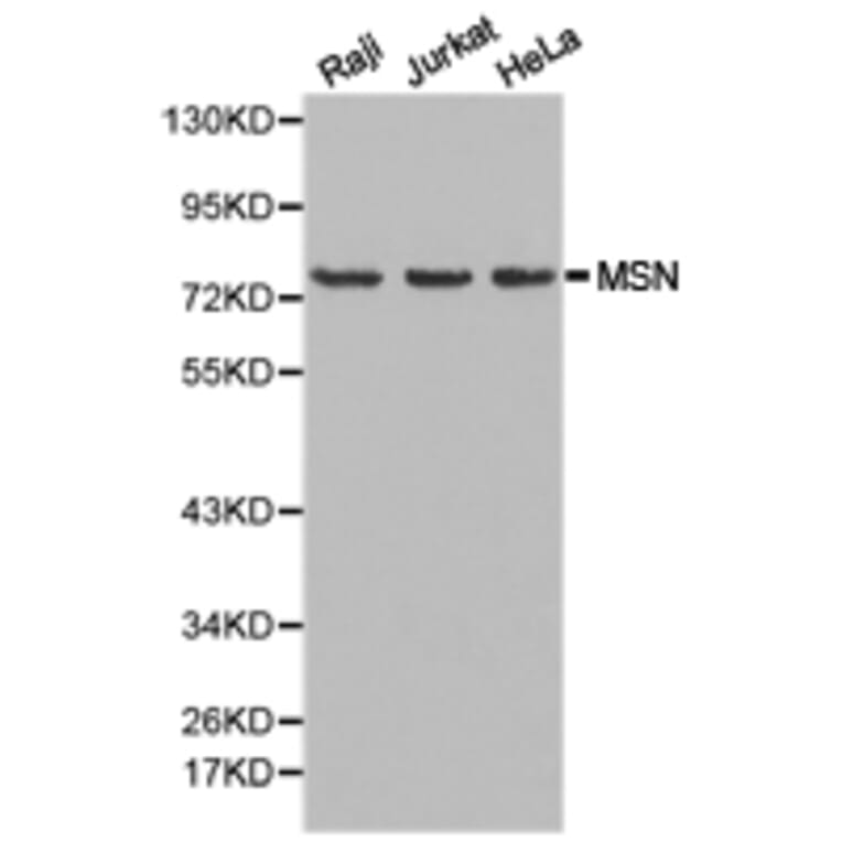 Anti-Moesin / MSN Antibody from Bioworld Technology (BS6925) - Antibodies.com