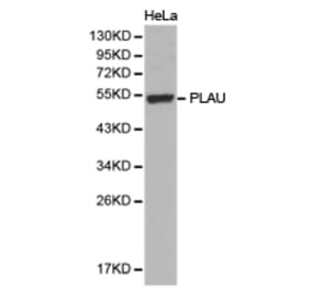 Anti-uPA / PLAU Antibody from Bioworld Technology (BS6927) - Antibodies.com
