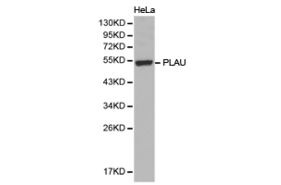 Anti-uPA / PLAU Antibody from Bioworld Technology (BS6927) - Antibodies.com