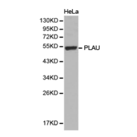 Anti-uPA / PLAU Antibody from Bioworld Technology (BS6927) - Antibodies.com