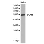 Anti-uPA / PLAU Antibody from Bioworld Technology (BS6927) - Antibodies.com
