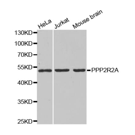 Anti-PPP2R2A Antibody from Bioworld Technology (BS6928) - Antibodies.com