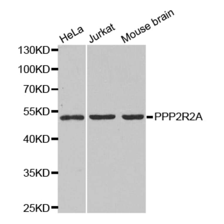 Anti-PPP2R2A Antibody from Bioworld Technology (BS6928) - Antibodies.com