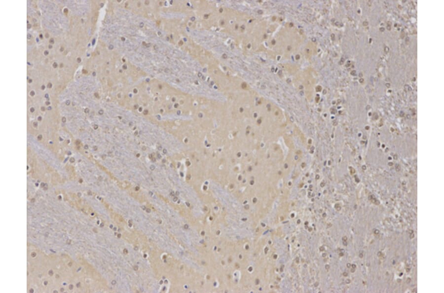 Anti-PPP2R2A Antibody from Bioworld Technology (BS6928) - Antibodies.com