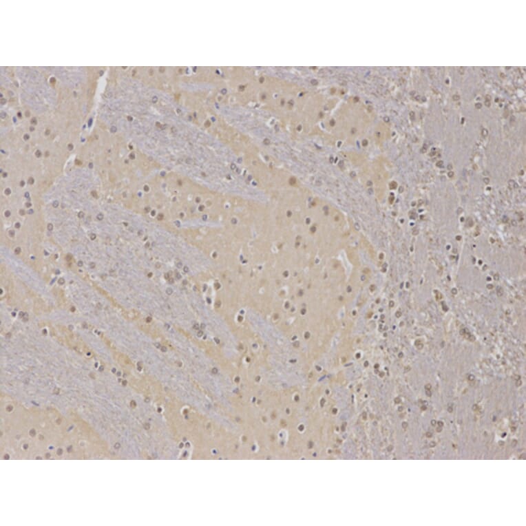 Anti-PPP2R2A Antibody from Bioworld Technology (BS6928) - Antibodies.com