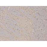Anti-PPP2R2A Antibody from Bioworld Technology (BS6928) - Antibodies.com