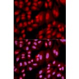 Anti-PPP2R2A Antibody from Bioworld Technology (BS6928) - Antibodies.com