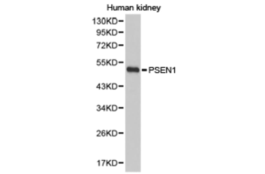 Anti-Presenilin 1 Antibody from Bioworld Technology (BS6929) - Antibodies.com