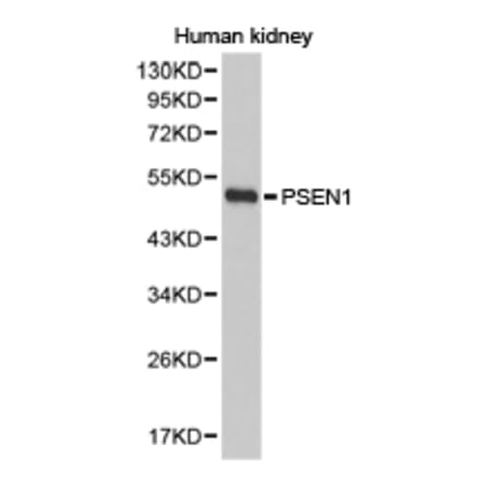 Anti-Presenilin 1 Antibody from Bioworld Technology (BS6929) - Antibodies.com