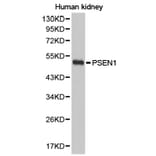 Anti-Presenilin 1 Antibody from Bioworld Technology (BS6929) - Antibodies.com