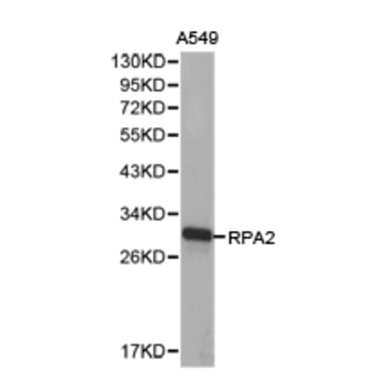 Anti-RPA2 Antibody from Bioworld Technology (BS6930) - Antibodies.com