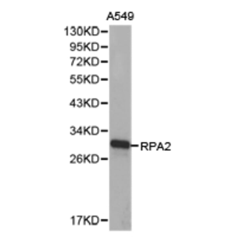 Anti-RPA2 Antibody from Bioworld Technology (BS6930) - Antibodies.com