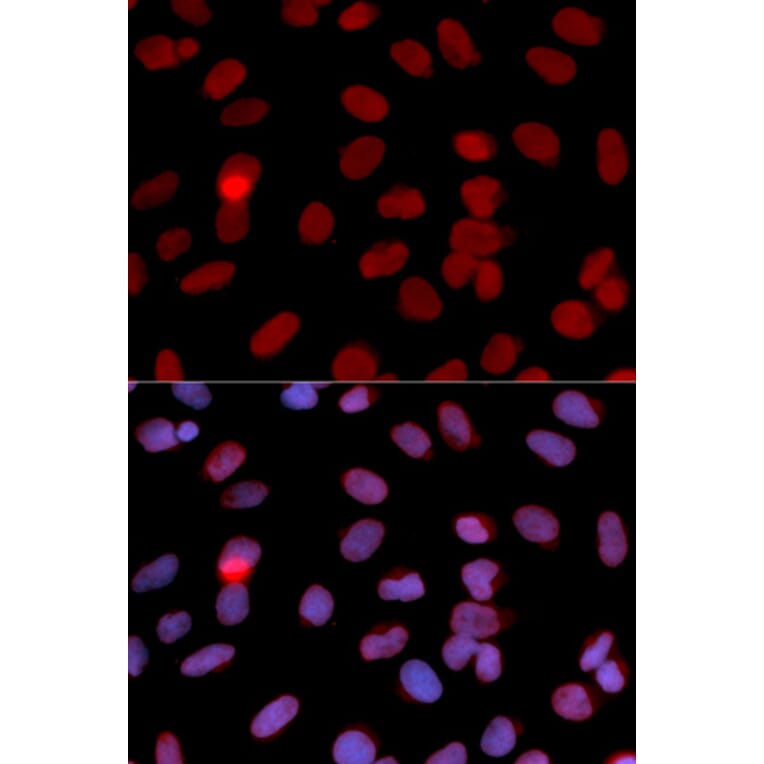 Anti-RPA2 Antibody from Bioworld Technology (BS6930) - Antibodies.com