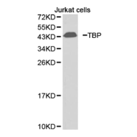 Anti-TBP Antibody from Bioworld Technology (BS6931) - Antibodies.com