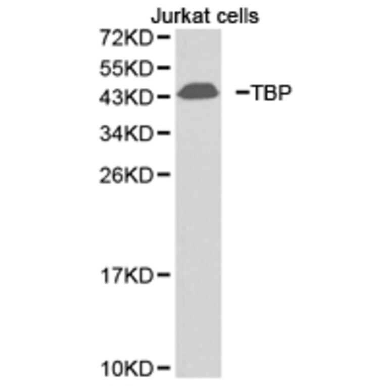 Anti-TBP Antibody from Bioworld Technology (BS6931) - Antibodies.com