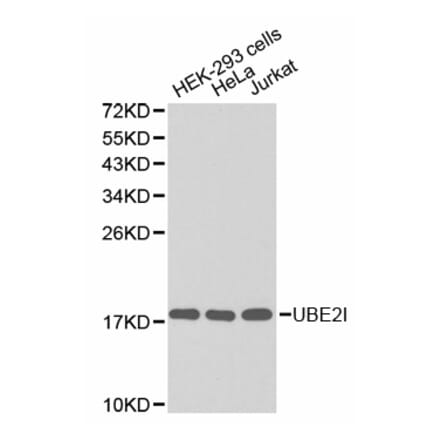 Anti-UBE2I Antibody from Bioworld Technology (BS6932) - Antibodies.com