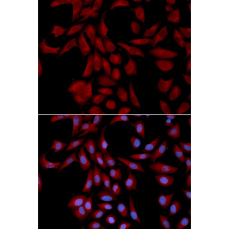 Anti-UBE2I Antibody from Bioworld Technology (BS6932) - Antibodies.com