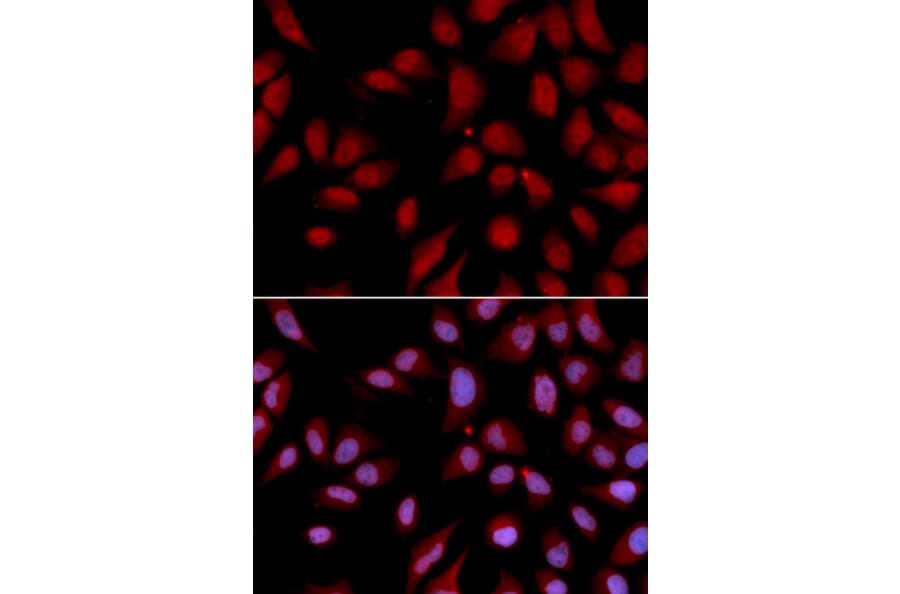 Anti-DLGAP5 Antibody from Bioworld Technology (BS6934) - Antibodies.com