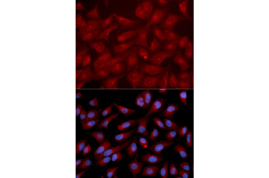 Anti-RAPGEF3 Antibody from Bioworld Technology (BS6936) - Antibodies.com