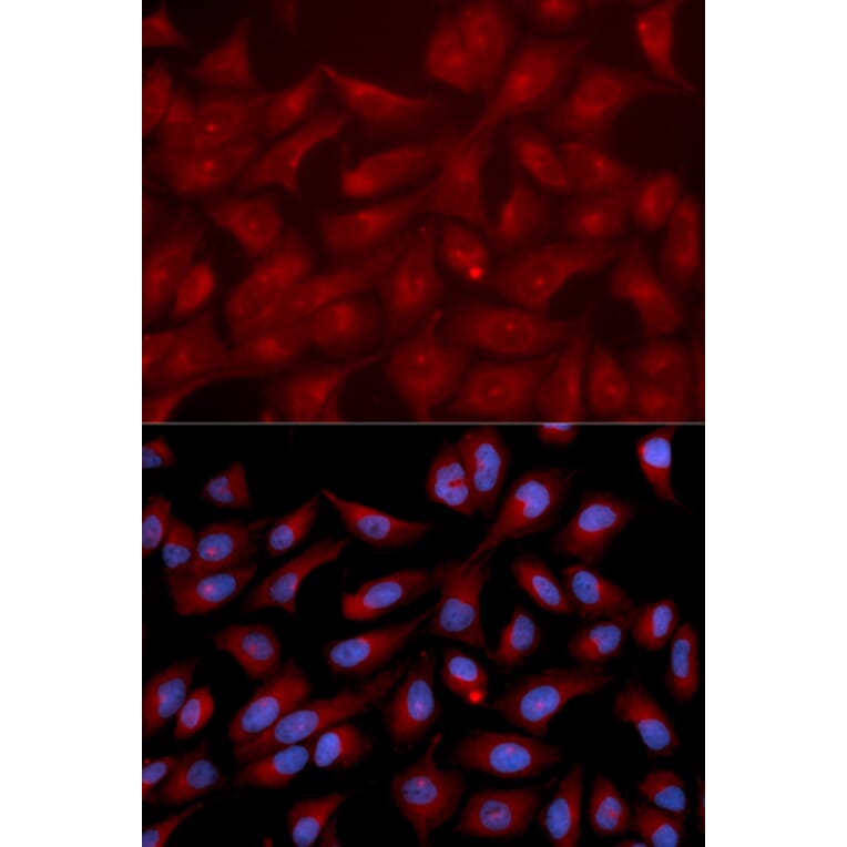Anti-RAPGEF3 Antibody from Bioworld Technology (BS6936) - Antibodies.com
