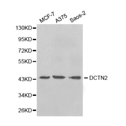 Anti-Dynactin 2 Antibody from Bioworld Technology (BS6937) - Antibodies.com