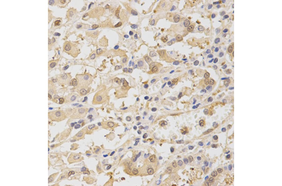 Anti-Tollip Antibody from Bioworld Technology (BS6938) - Antibodies.com