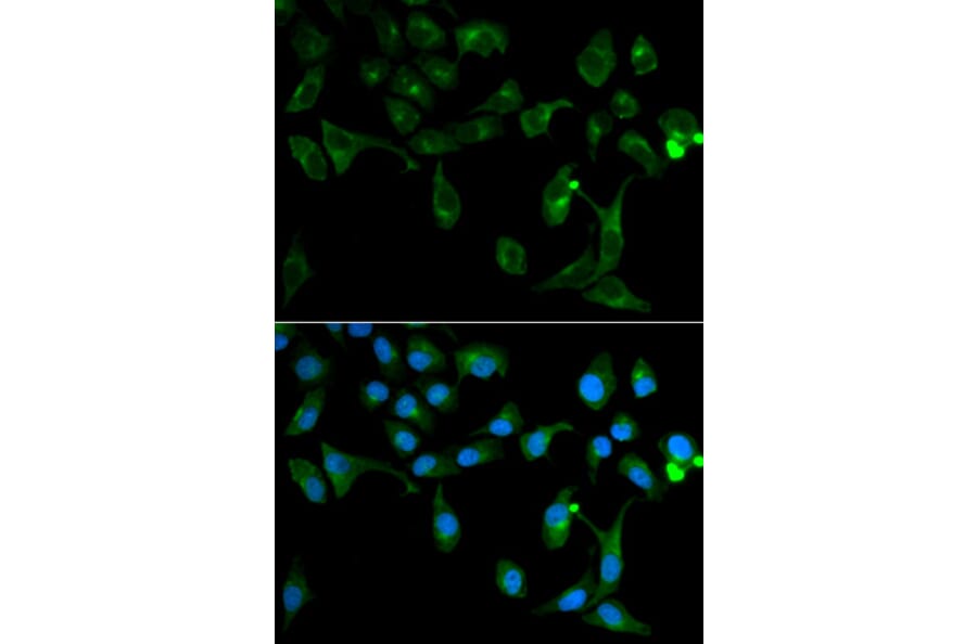 Anti-Tollip Antibody from Bioworld Technology (BS6938) - Antibodies.com