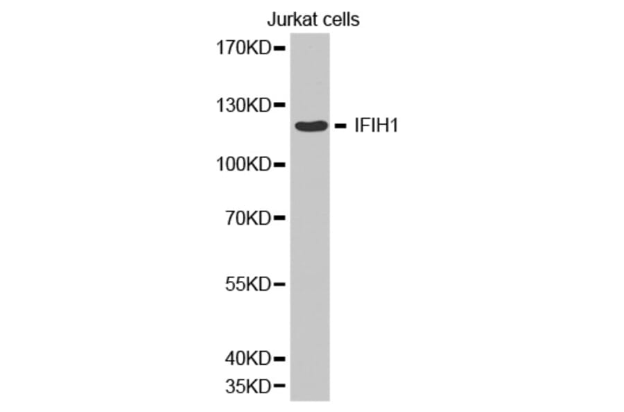 Anti-IFIH1 Antibody from Bioworld Technology (BS6939) - Antibodies.com