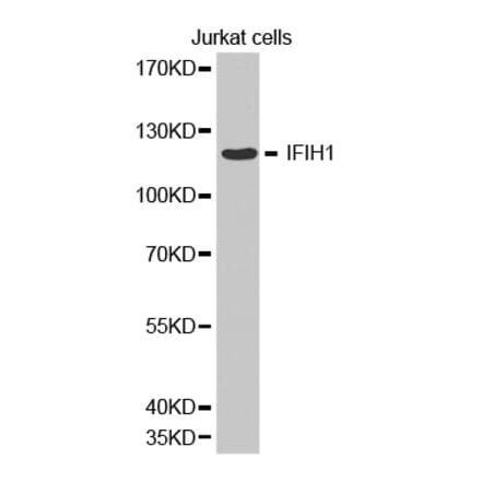 Anti-IFIH1 Antibody from Bioworld Technology (BS6939) - Antibodies.com