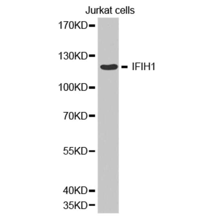 Anti-IFIH1 Antibody from Bioworld Technology (BS6939) - Antibodies.com