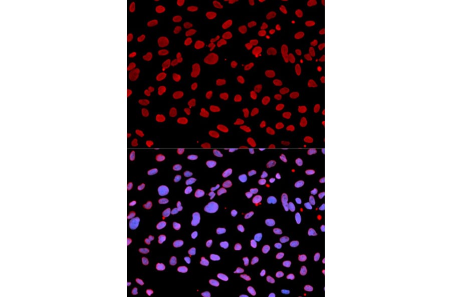 Anti-IFIH1 Antibody from Bioworld Technology (BS6939) - Antibodies.com