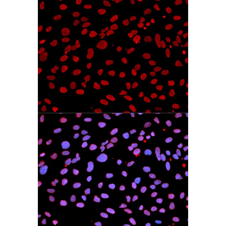 Anti-IFIH1 Antibody from Bioworld Technology (BS6939) - Antibodies.com